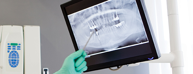 dentist pointing to an x-ray